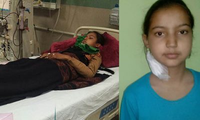 poor Solan girl dies of kidney failure