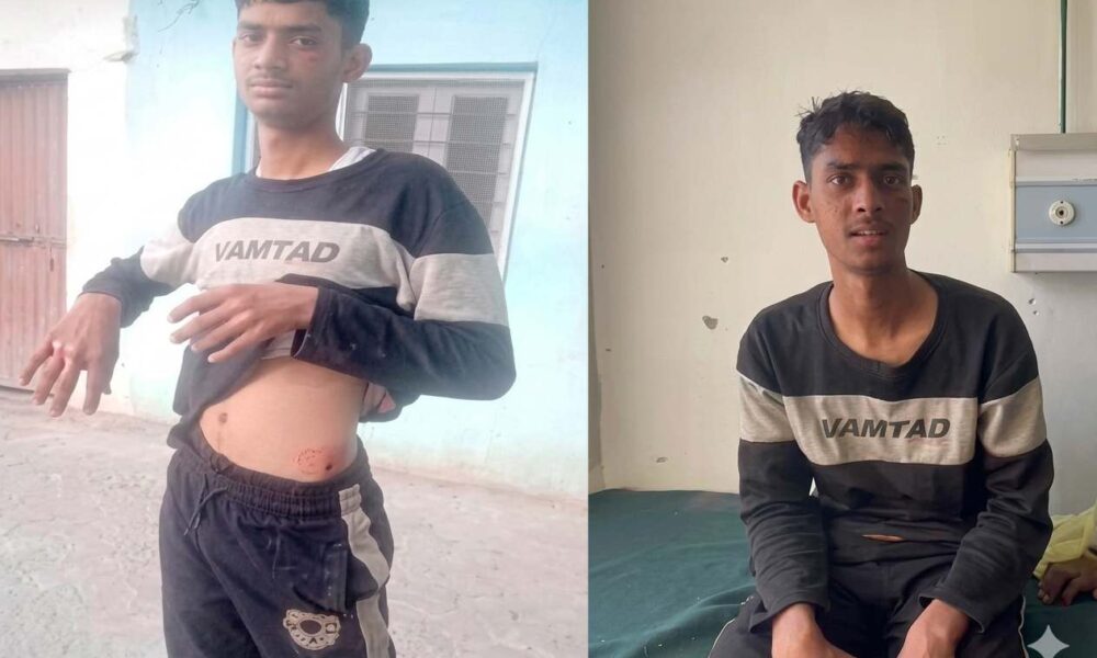 solan teen kills leopard