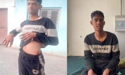 solan teen kills leopard