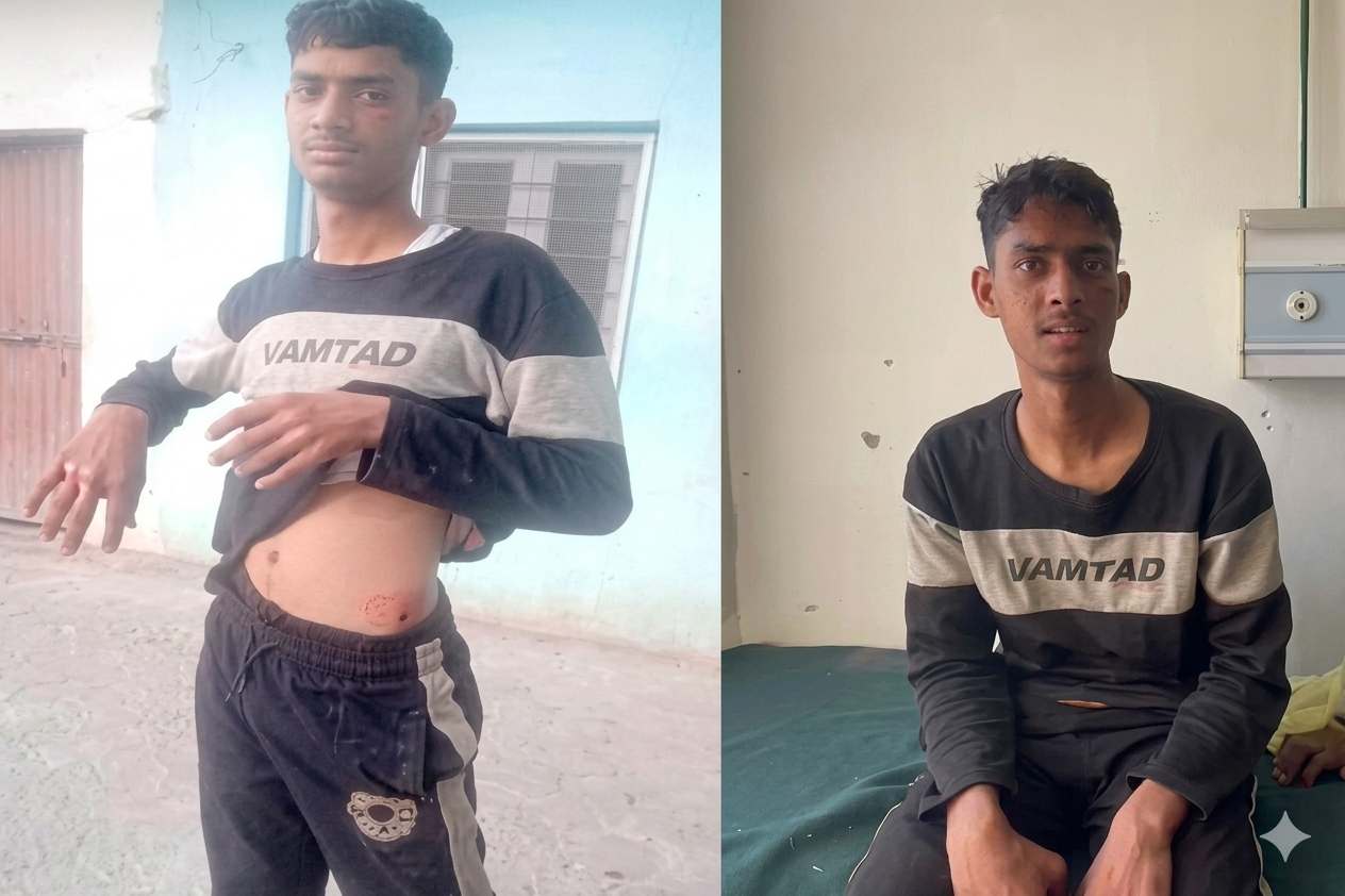 solan teen kills leopard
